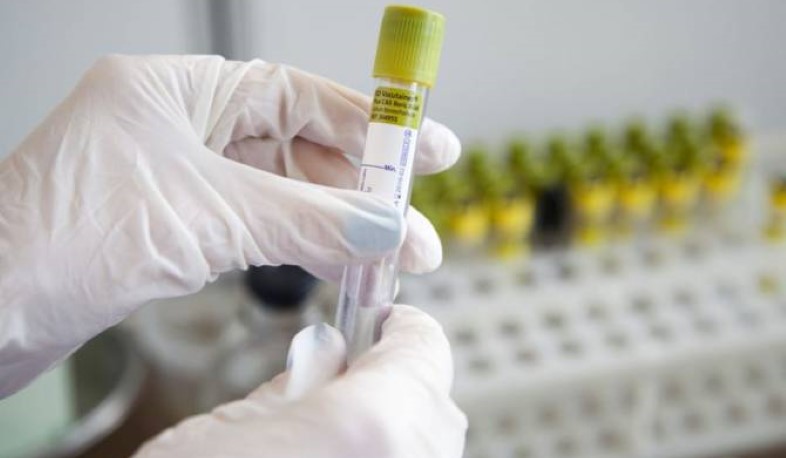 Հաստատված դեպքերի թիվը` 265, առողջացել է 16 քաղաքացի․ 10։00