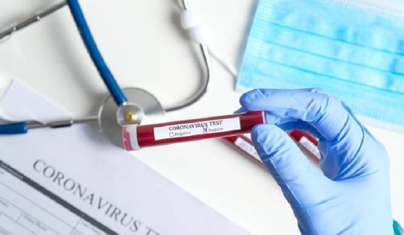 Օտարերկրյա ԶԼՄ-ներից կորոնավիրուսի վերաբերյալ նյութերի արտատպման դեպքում պետք է վերնագրում հրապարակվի նյութի սկզբնաղբյուրը