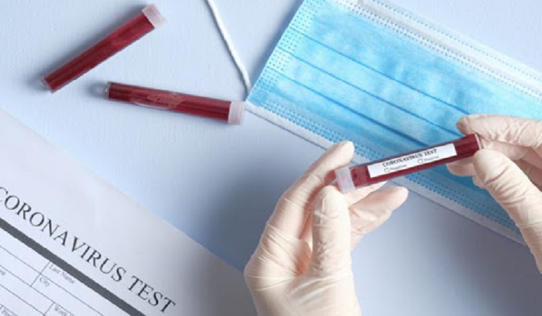 Արցախում առայսօր կորոնավիրուսի դեպք չի գրանցվել. ԱՆ