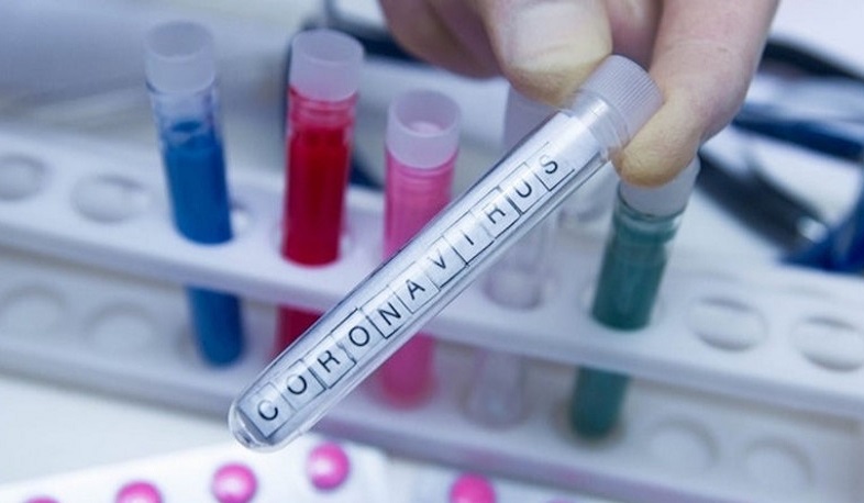 Կորոնավիրուսից 89-ամյա քաղաքացի է մահացել. նա ունեցել է խրոնիկ հիվանդություններ