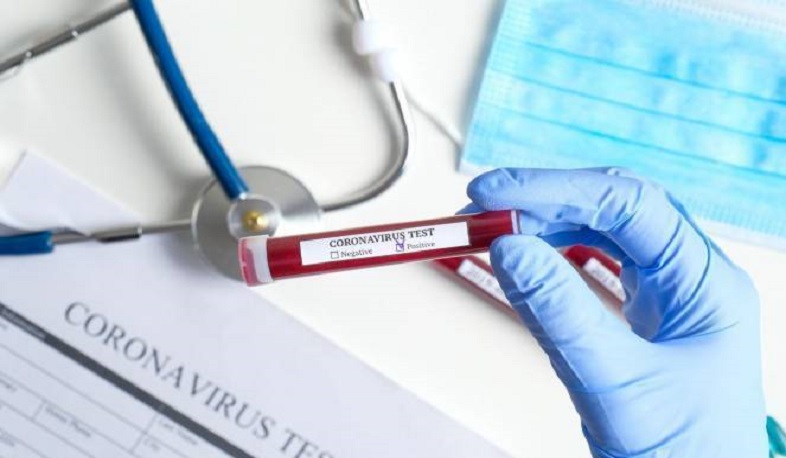 Հայաստանում կորոնավիրուսից բուժվածների թիվը 43 է