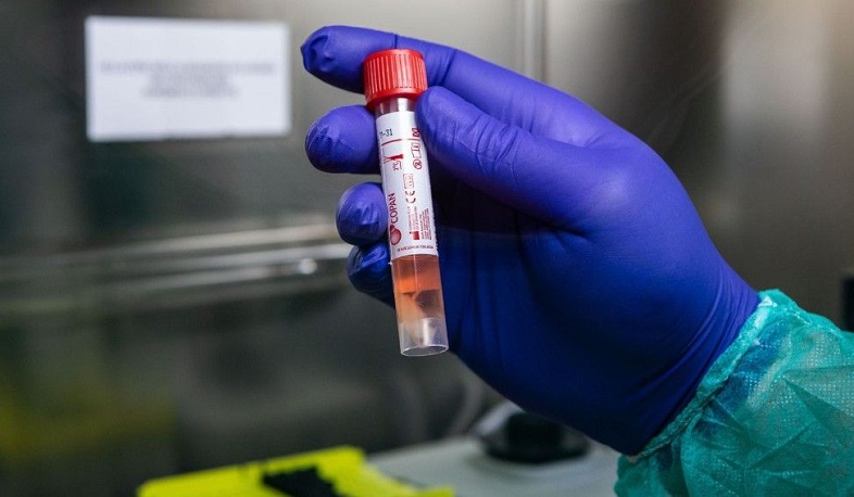 Գեղարքունիքում կորոնավիրուսի հաստատված դեպքերը 63-ն են