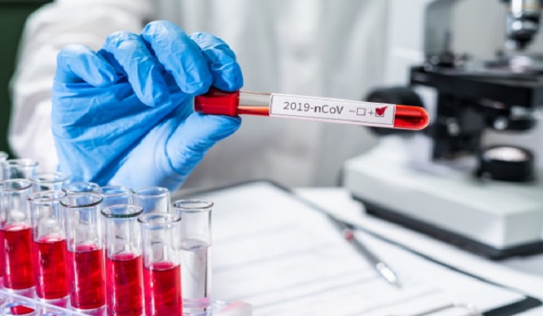 Արցախում կորոնավիրուսով վարակված 8 անձից 6-ն առողջացել են