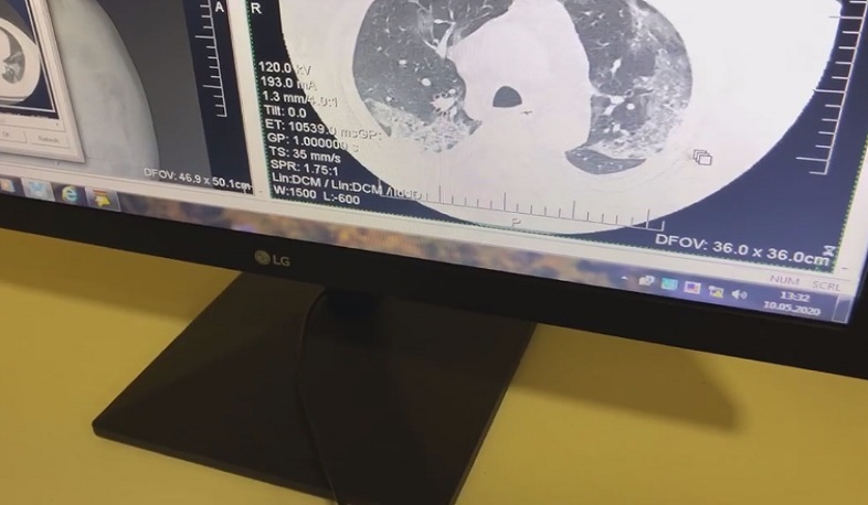 Թորոսյանը Սուրբ Գրիգոր Լուսավորիչ ԲԿ-ում այցելել է ախտորոշիչ բաժանմունք. ՈՒՂԻՂ