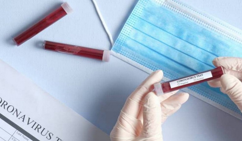 Արցախում կորոնավիրուսով վարակվածների թիվը 14 է, 8-ն ապաքինվել են