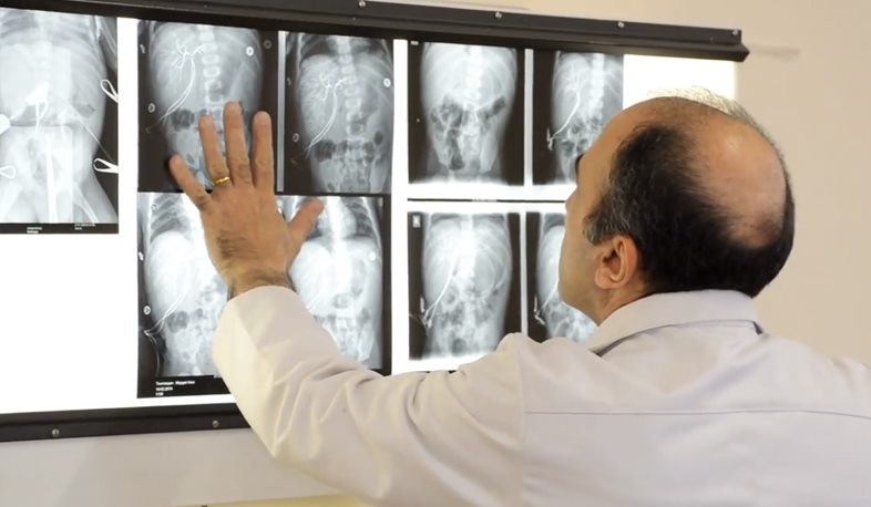 Լյարդի փոխպատվաստում «Արաբկիր» բժշկական համալիրում