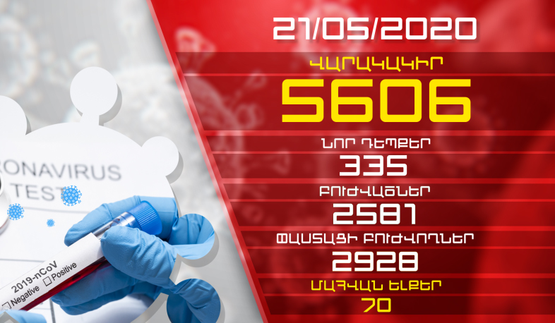 Update. 21.05.2020.  335 new cases of infection with coronavirus have been confirmed, 162 have recovered